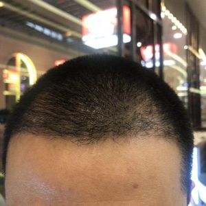发际线分享社区