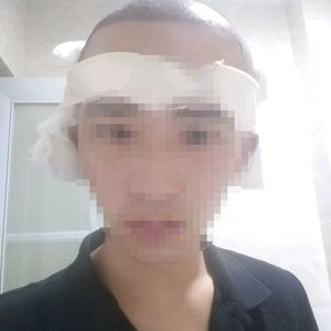 发际线分享社区