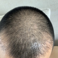 發(fā)際線用戶圖片
