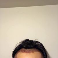 發(fā)際線用戶圖片