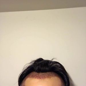 发际线分享社区