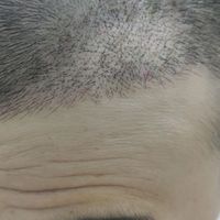 發(fā)際線用戶圖片