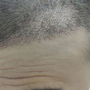 发际线分享社区