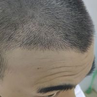 發(fā)際線用戶圖片