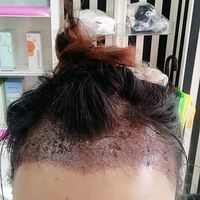 發(fā)際線用戶圖片