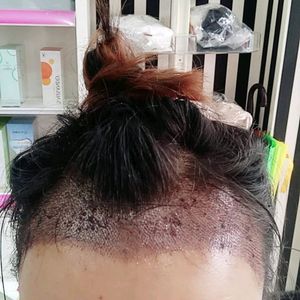 发际线分享社区