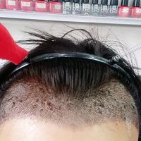 發(fā)際線用戶圖片