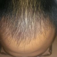 發(fā)際線用戶圖片