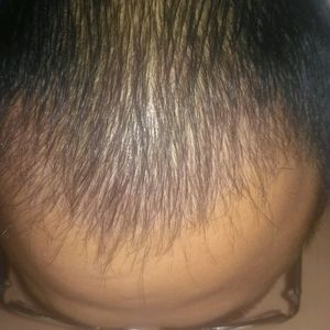 发际线分享社区
