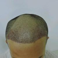 發(fā)際線用戶圖片