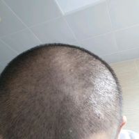 發(fā)際線用戶圖片