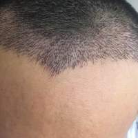 發(fā)際線用戶圖片