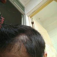 發(fā)際線用戶圖片
