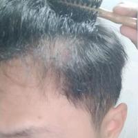 發(fā)際線用戶圖片