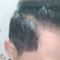 發(fā)際線用戶圖片