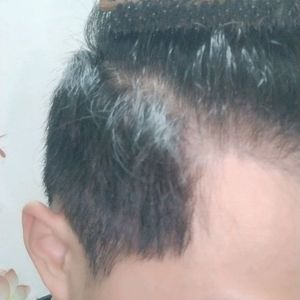 发际线分享社区