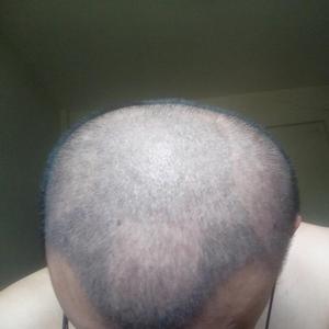 发际线分享社区