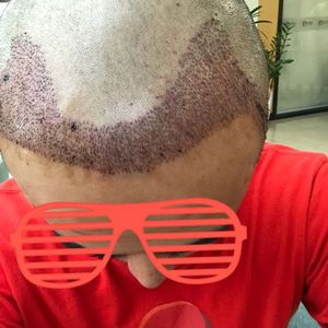 发际线分享社区