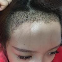 發(fā)際線用戶圖片