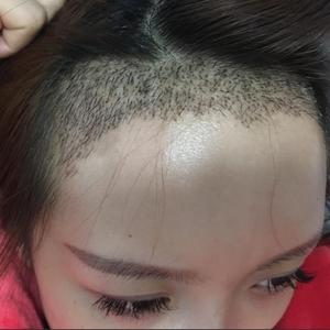 发际线分享社区