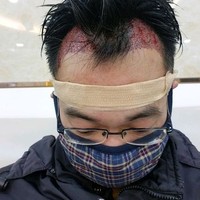 發(fā)際線(xiàn)用戶(hù)圖片