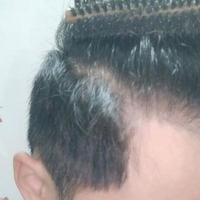 發(fā)際線(xiàn)用戶(hù)圖片
