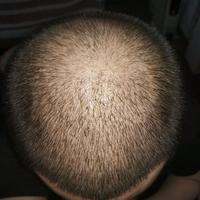 發(fā)際線(xiàn)用戶(hù)圖片