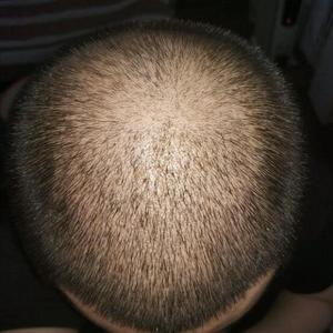 发际线分享社区