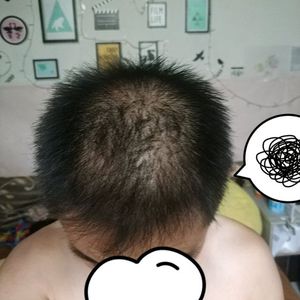 发际线分享社区