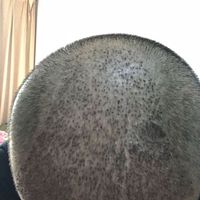 發(fā)際線(xiàn)用戶(hù)圖片
