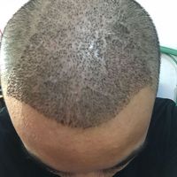 發(fā)際線(xiàn)用戶(hù)圖片