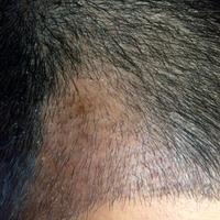 發(fā)際線(xiàn)用戶(hù)圖片