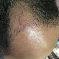 發(fā)際線(xiàn)用戶(hù)圖片