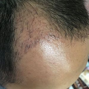 发际线分享社区