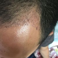 發(fā)際線(xiàn)用戶(hù)圖片