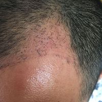 發(fā)際線用戶圖片