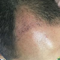 發(fā)際線用戶圖片