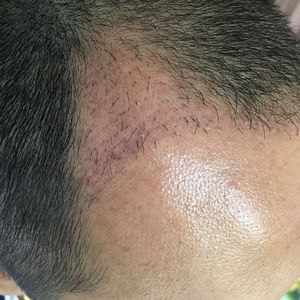 发际线分享社区