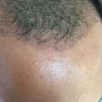 發(fā)際線用戶圖片