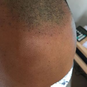 发际线分享社区