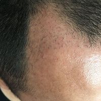 發(fā)際線用戶圖片