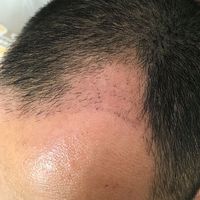 發(fā)際線用戶圖片