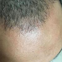發(fā)際線用戶圖片