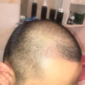 发际线分享社区