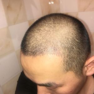 发际线分享社区