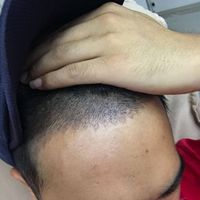 發(fā)際線用戶圖片