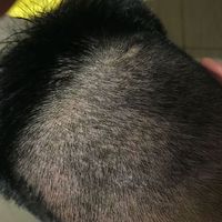 發(fā)際線用戶圖片