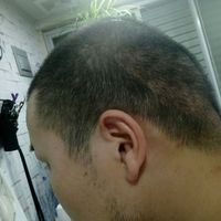 發(fā)際線用戶圖片