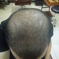 發(fā)際線用戶圖片