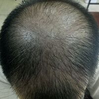 發(fā)際線用戶圖片